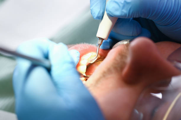 Best Walk-In Emergency Dentist in Falmouth, KY