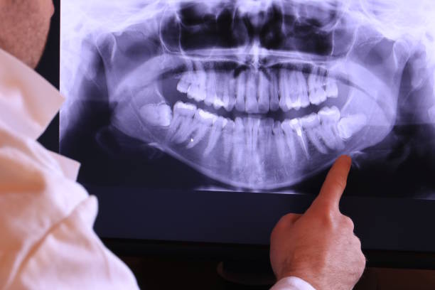 Best Emergency Tooth Extraction in Falmouth, KY